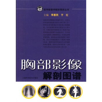 胸部影像解剖圖譜 pdf epub mobi 電子書 下載