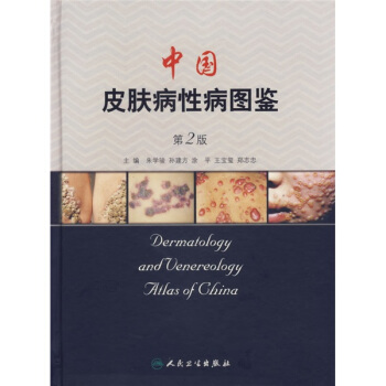 中国皮肤病性病图鉴（第2版） pdf epub mobi 电子书 下载