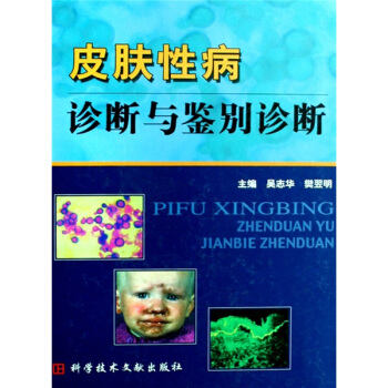 皮膚性病診斷與鑒彆診斷
