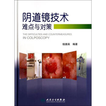 陰道鏡技術難點與對策(精) 錢德英 正版書籍 科技 pdf epub mobi 電子書 下載