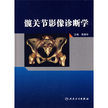髖關節影像診斷學 pdf epub mobi 電子書 下載
