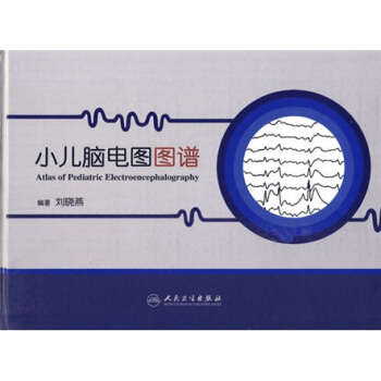 小兒腦電圖圖譜 pdf epub mobi 電子書 下載