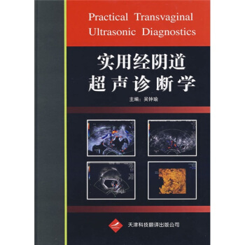 实用经阴道超声诊断学 [Practical Transvaginal Ultrasonic Diagnostics] pdf epub mobi 电子书 下载