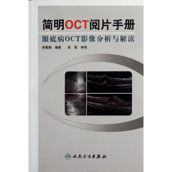 簡明OCT閱片手冊 pdf epub mobi 電子書 下載