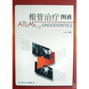 根管治療圖譜(精)
