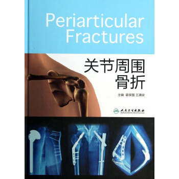 關節周圍骨摺 pdf epub mobi 電子書 下載