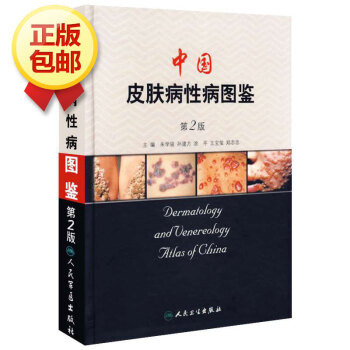 中国皮肤病性病图鉴(2版) pdf epub mobi 电子书 下载