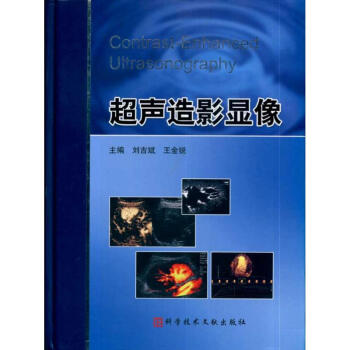 超聲造影顯像 pdf epub mobi 電子書 下載