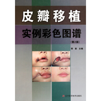 皮瓣移植實例彩色圖譜(第2版)(精)