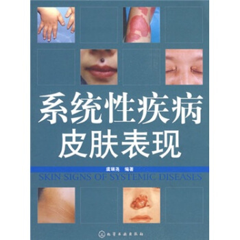 系统性疾病皮肤表现 pdf epub mobi 电子书 下载