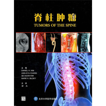 脊柱腫瘤 [Tumors of the Spine] pdf epub mobi 電子書 下載