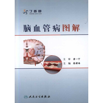 腦血管病圖解 pdf epub mobi 電子書 下載