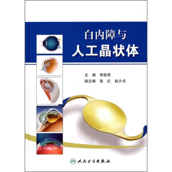 白內障與人工晶狀體 pdf epub mobi 電子書 下載