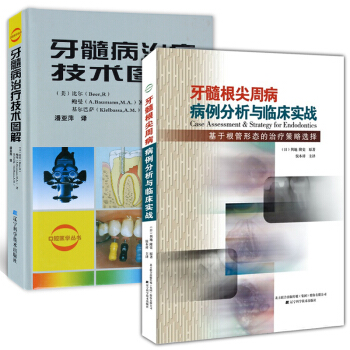 牙髓病治疗技术图解+牙髓根尖周病病例分析与临床实战:基于根管形态的治疗疾病策略选择 pdf epub mobi 电子书 下载