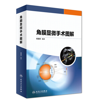 正版现货 角膜显微手术图解 杨朝忠编著 人民卫生出版社 pdf epub mobi 电子书 下载
