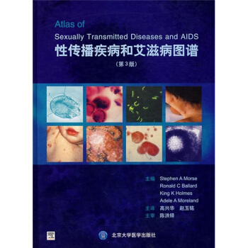性傳播疾病和艾滋病圖譜（第3版） [Sexually Transmitted Diseases and AIDS] pdf epub mobi 電子書 下載