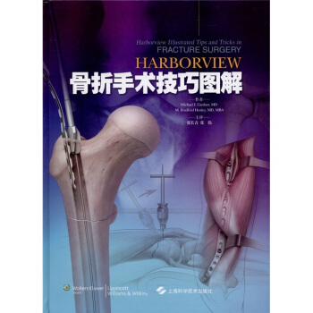 Harborview 骨折手术技巧图解 pdf epub mobi 电子书 下载