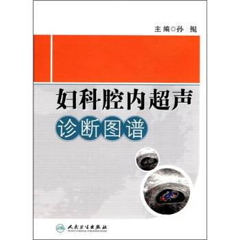 婦科腔內超聲診斷圖譜 pdf epub mobi 電子書 下載