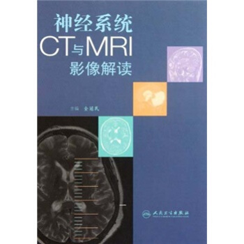 神经系统CT与MRI影像解读 pdf epub mobi 电子书 下载