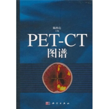 PET-CT圖譜 pdf epub mobi 電子書 下載