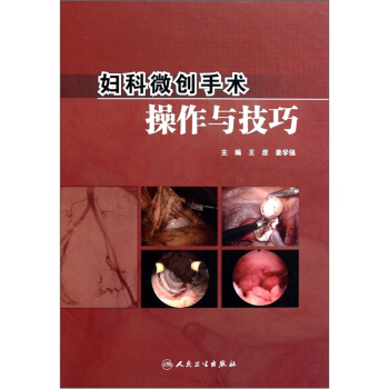 婦科微創手術操作與技巧（附光盤） pdf epub mobi 電子書 下載