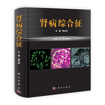 肾病综合征 pdf epub mobi 电子书 下载
