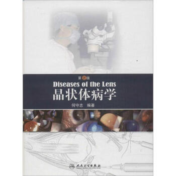 晶狀體病學(第2版) pdf epub mobi 電子書 下載