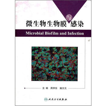 微生物生物膜與感染 [Microbial Biofilm and Infection] pdf epub mobi 電子書 下載