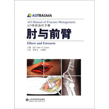 AO骨摺治療手冊：肘與前臂 [AO Manual of Fracture Management] pdf epub mobi 電子書 下載