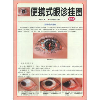 便携式眼诊挂图（附光盘1张） pdf epub mobi 电子书 下载