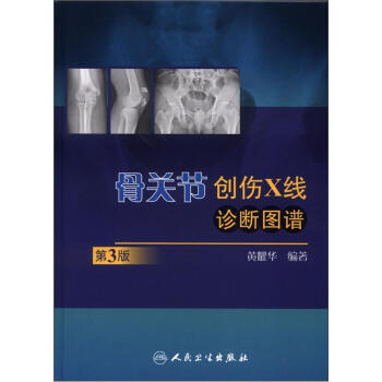 骨關節創傷X綫診斷圖譜（第3版） pdf epub mobi 電子書 下載