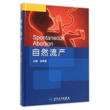 自然流产 pdf epub mobi 电子书 下载