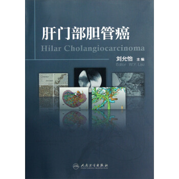 肝門部膽管癌 pdf epub mobi 電子書 下載