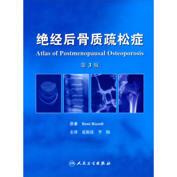 绝经后骨质疏松症（第3版） [Atlas of Postmenopausal Osteoporosis] pdf epub mobi 电子书 下载