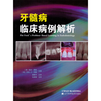 牙髓病臨床病例解析 pdf epub mobi 電子書 下載