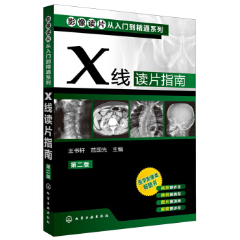影像讀片從入門到精通係列:X綫讀片指南(第2版)