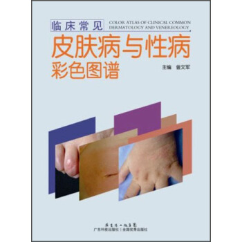 臨床常見皮膚病與性病彩色圖譜