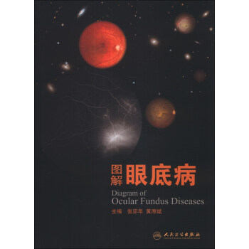 圖解眼底病 [Diagram of Ocular Fundus Diseases] pdf epub mobi 電子書 下載
