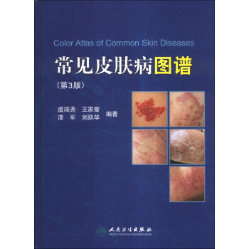 常見皮膚病圖譜（第3版） [Color Atlas of Common Skin Diseases] pdf epub mobi 電子書 下載