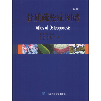 骨质疏松症图谱（第3版） [Atlas of Osteoporosis] pdf epub mobi 电子书 下载