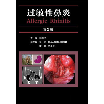 過敏性鼻炎（第2版） [Allergic Rhinitis] pdf epub mobi 電子書 下載