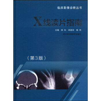 臨床影像診斷叢書:X綫讀片指南(第3版)