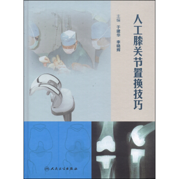 人工膝關節置換技巧 pdf epub mobi 電子書 下載