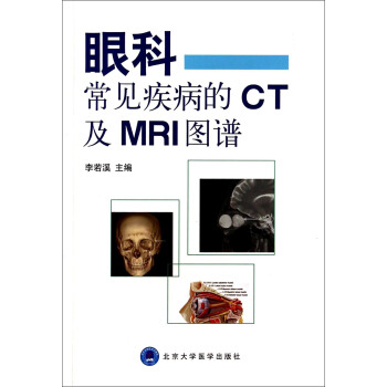 眼科常見疾病的CT及MRI圖譜 pdf epub mobi 電子書 下載