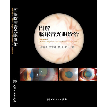 圖解臨床青光眼診治