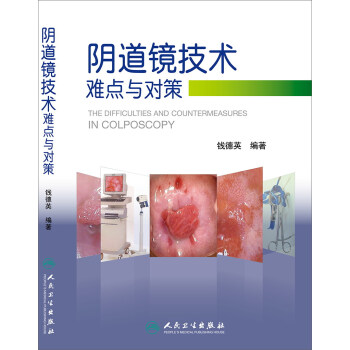 陰道鏡技術難點與對策 pdf epub mobi 電子書 下載