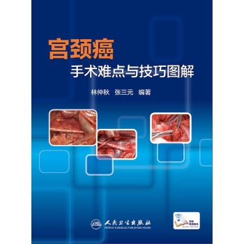 宫颈癌手术难点与技巧图解 pdf epub mobi 电子书 下载