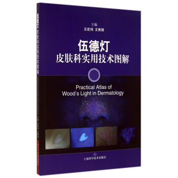 伍德燈皮膚科實用技術圖解 pdf epub mobi 電子書 下載