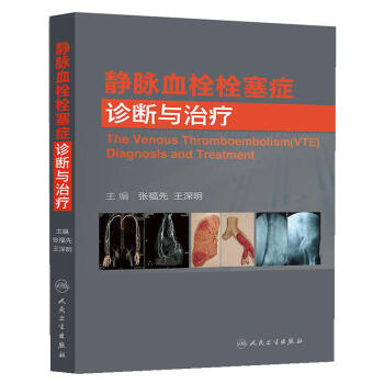 靜脈血栓栓塞癥診斷與治療 [The Venous Thromboembolism(VTE) Diagnosis and Treatment] pdf epub mobi 電子書 下載