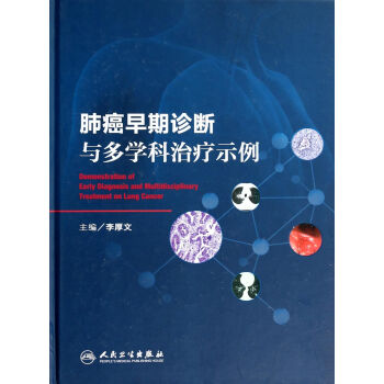 肺癌早期診斷與多學科治療示例 [Demonstration of Early Diagnosis and Multidisciplinary Treatment on Lung Cancer] pdf epub mobi 電子書 下載